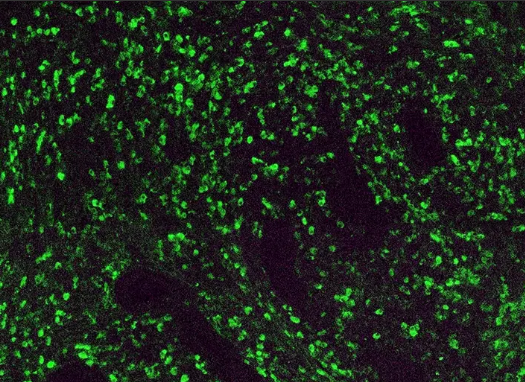Ovalbumin-PEG-FITC	鸡卵白蛋白-聚乙二醇-异硫氰基荧光素